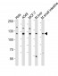 ZNF281 Antibody (Center)